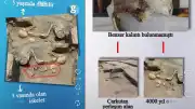 Özbekistan'da 4000 Yıllık Çocuk İskeletinde Tarihin En Eski Kafatası Ameliyatı İzleri Bulundu