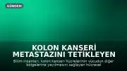 Kolon Kanseri Metastazını Tetikleyen Mekanizma Keşfedildi
