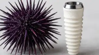 Deniz kestanesi kabuklarından yeni nesil implant üretimi hedefleniyor