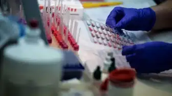 Boston Üniversitesi Araştırması: Uzun Yaşamın Sırrı Kan Testlerinde Gizli Olabilir