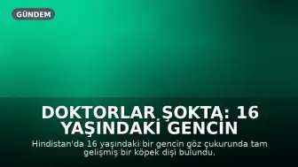 Doktorlar Şokta: 16 Yaşındaki Gencin Göz Çukurunda Diş Çıkarıldı